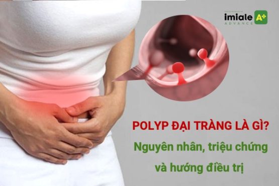 Polyp đại tràng