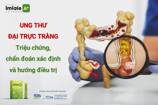 Ung thư đại trực tràng