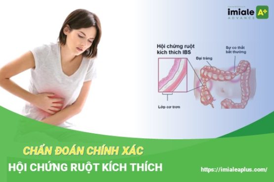 Tiêu chuẩn chẩn đoán hội chứng ruột kích thích - Dấu hiệu nhận biết chính xác nhất