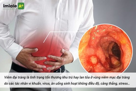 Bệnh lý viêm đại tràng 